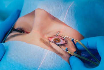 Who and when discovered the laser eye surgery technique?