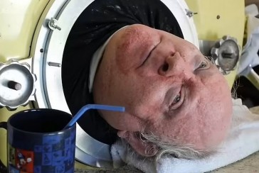 He lived with an 'iron lung' for 70 years: Who is Paul Alexander?