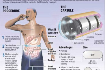 Who discovered Capsule endoscopy?