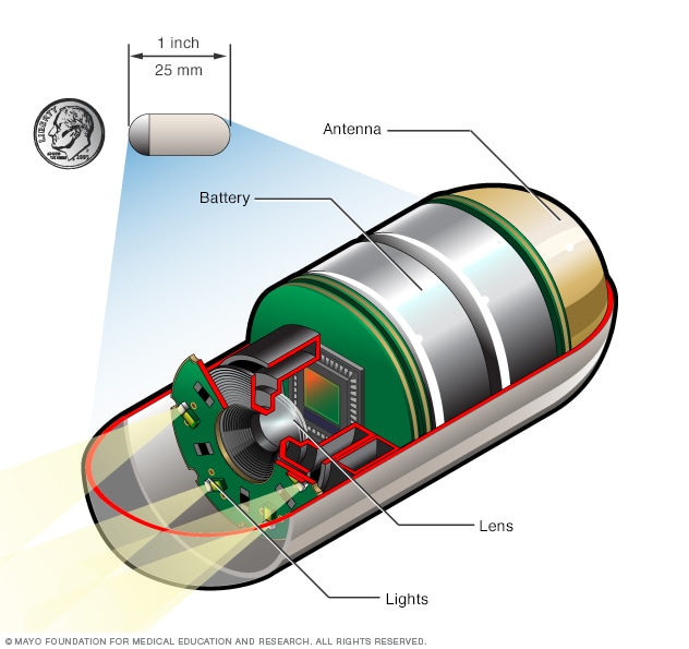 Who discovered Capsule endoscopy?