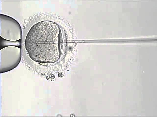 Who developed infertility treatment and how?