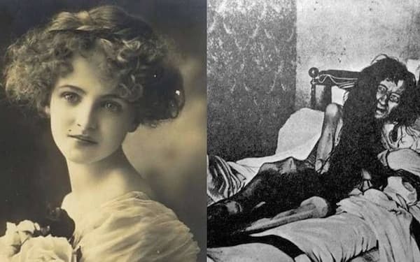 She was very beautiful, a very attractive woman, but her mother... Who is Blanche Monnier?