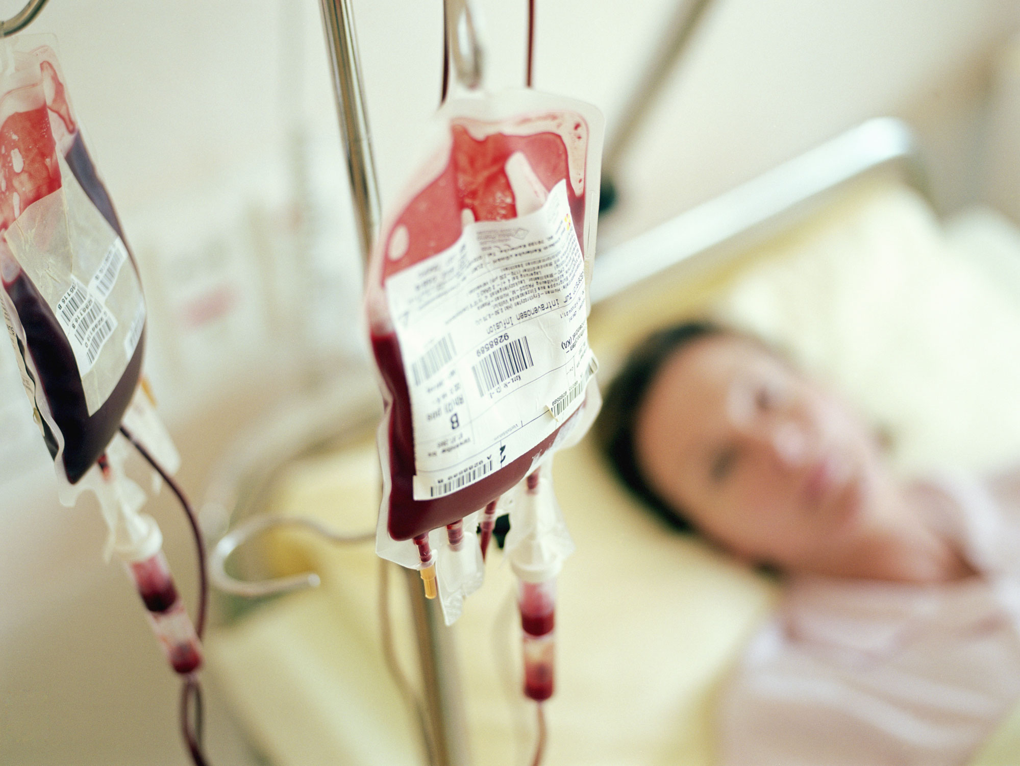 Who invented the blood transfusion and when?