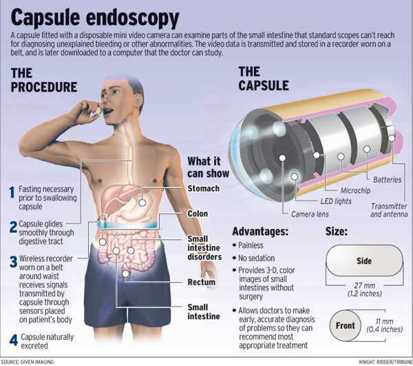 Who discovered Capsule endoscopy?